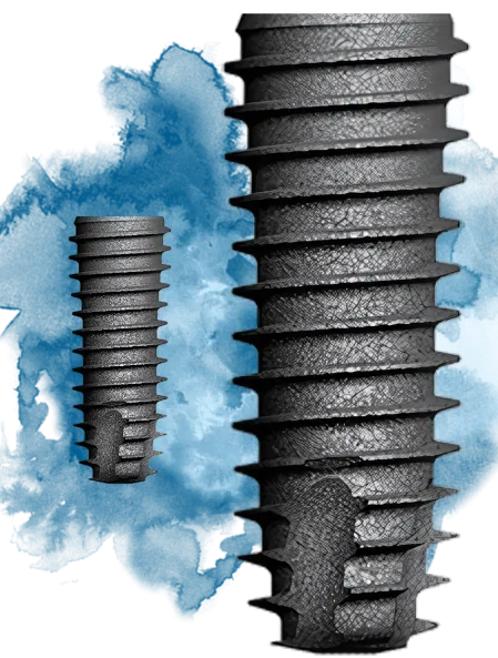 Dental Implants